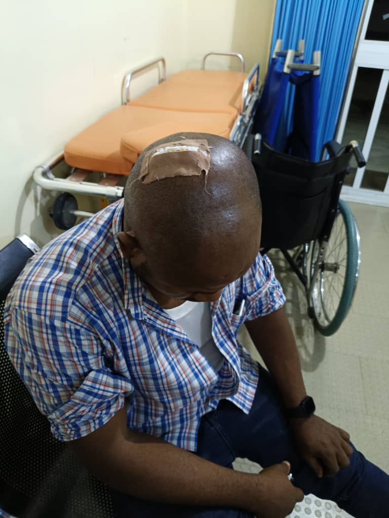 AEDC officials badly injured during anti-electricity theft operation in Abuja Police quarters