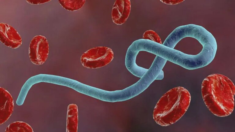 Ebola outbreak could cost Africa $3.6 bn, says UN
