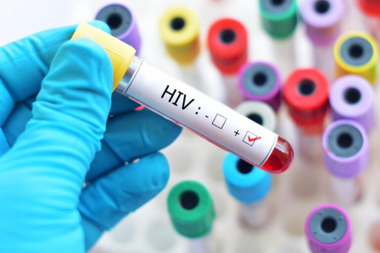 Interpretation of Lagos HIV data misleading, figures reflect routine testing- Official